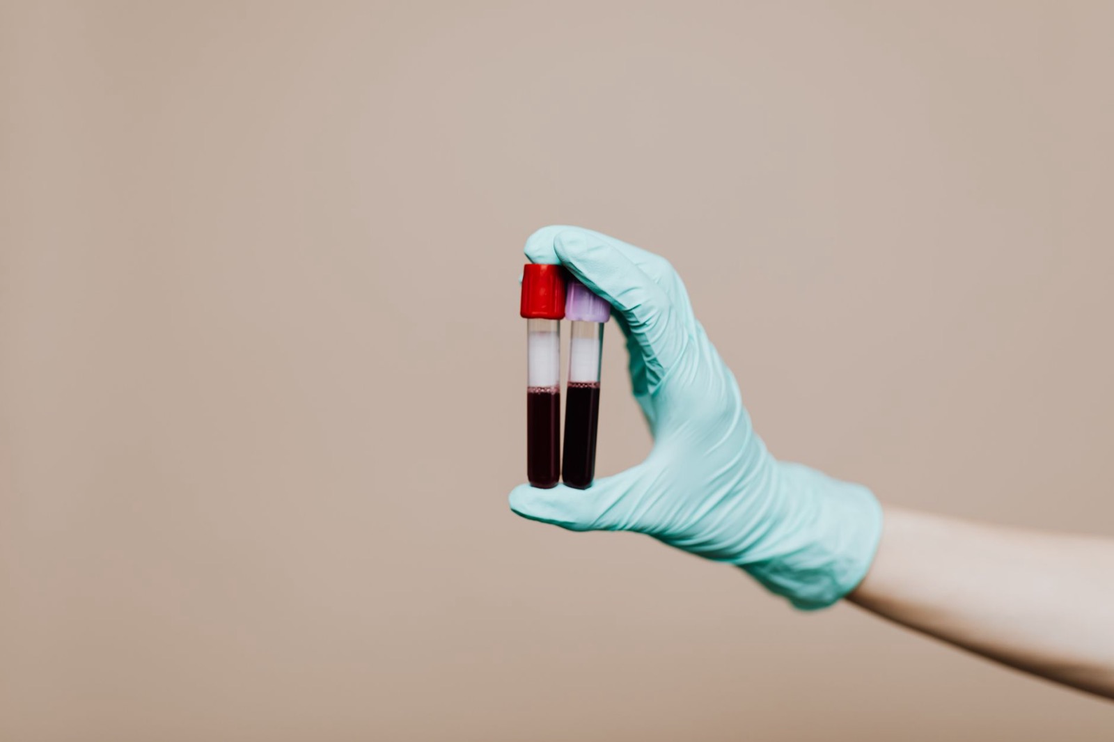 Platelet-rich plasma preparation tubes in a clinical setting