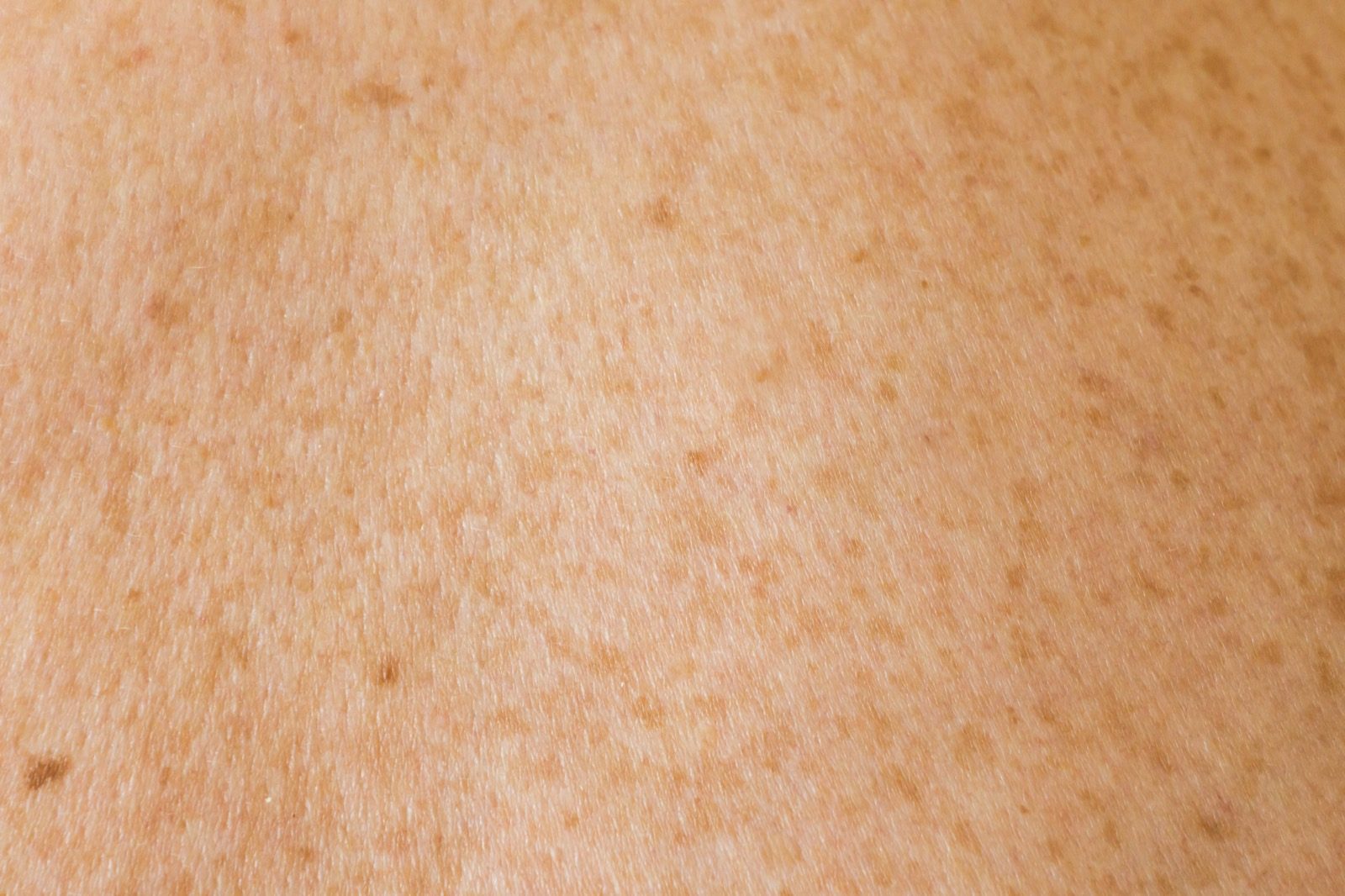 Close-up of skin texture and tone
